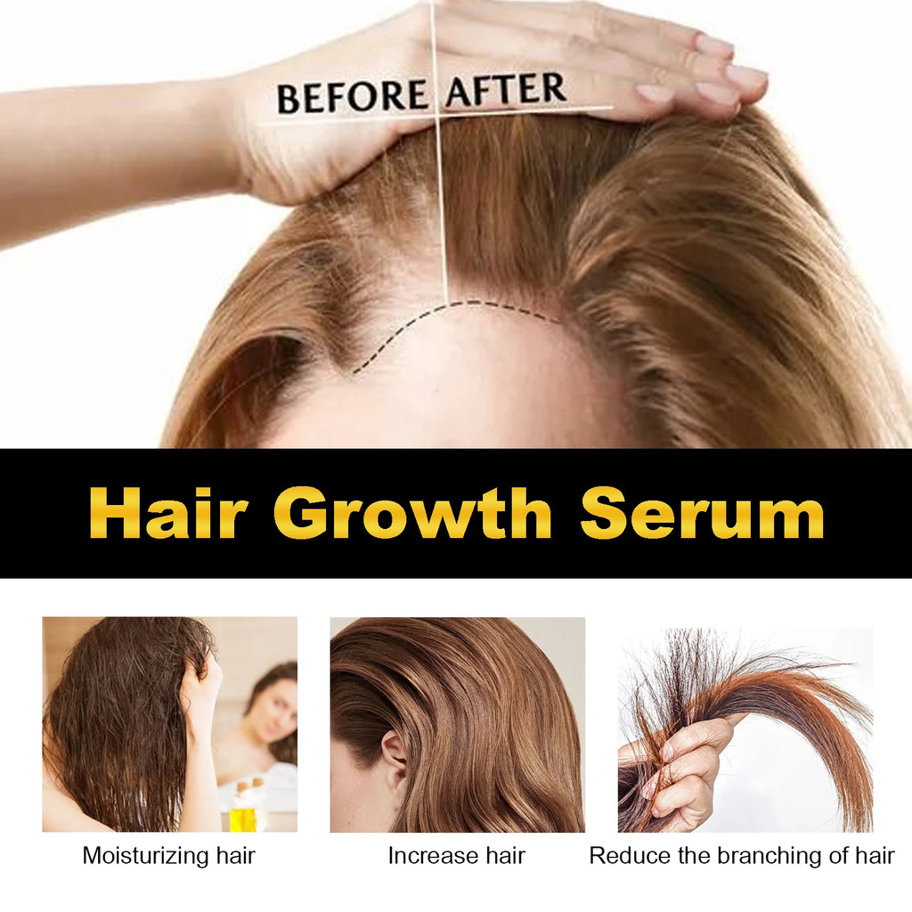 Hoegoa 30ml Castor Oil Hair Thickening Essential Oil Nourish Scalp Massage Refreshing Hair Growth Repair Smoothing Hair Care Oil - AliExpress 66