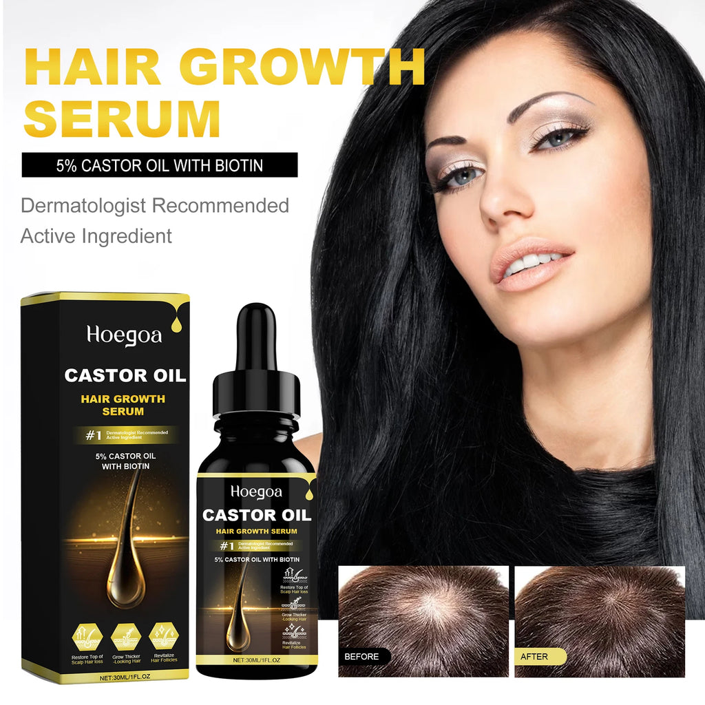 Hoegoa 30ml Castor Oil Hair Thickening Essential Oil Nourish Scalp Massage Refreshing Hair Growth Repair Smoothing Hair Care Oil - AliExpress 66