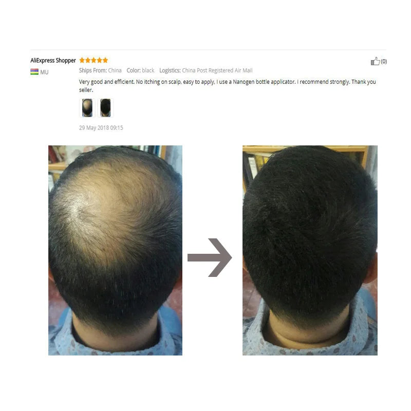 Hair Fibers Regrowth Powders Black Volumizing Hair Fibers Hair Building Fiber Natural Keratin Hair Styling Thickening Powder