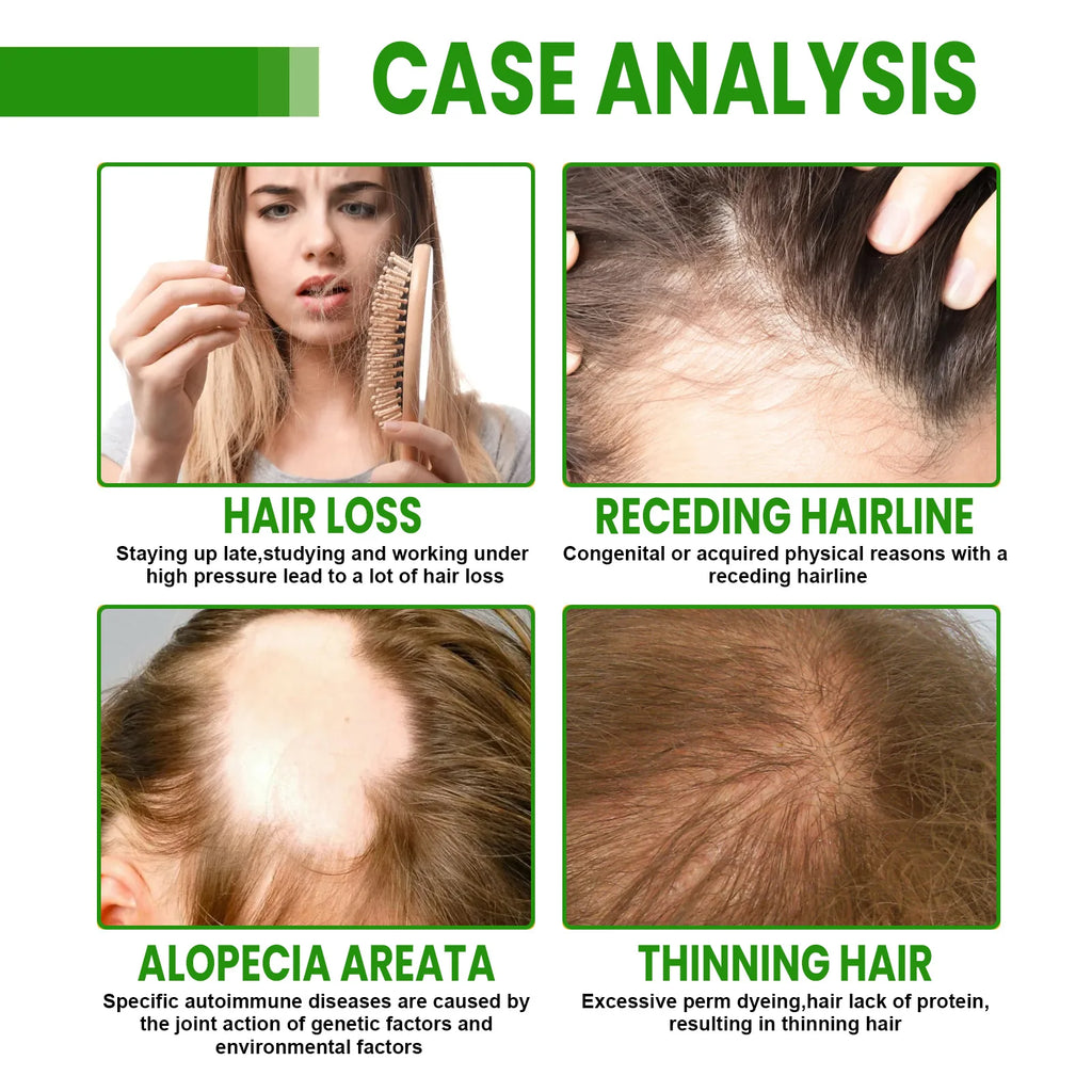 Rosemary Hair Growth Spray - Helps Strengthen Roots, Reduce Hair Loss, Nourish Dry Damaged Hair, Natural Essential Oil Treatment - AliExpress 66