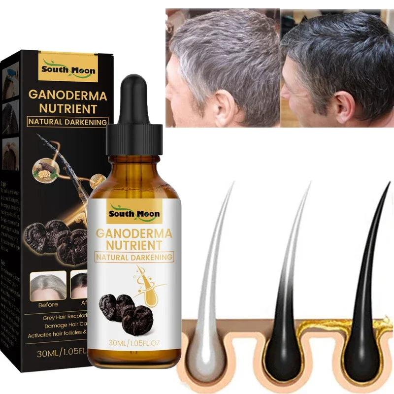 Gray White Hair Treatment Serum Liquid White To Black Natural Color Repair Nourish Products Anti Loss Hair Care for Men Women - AliExpress 66