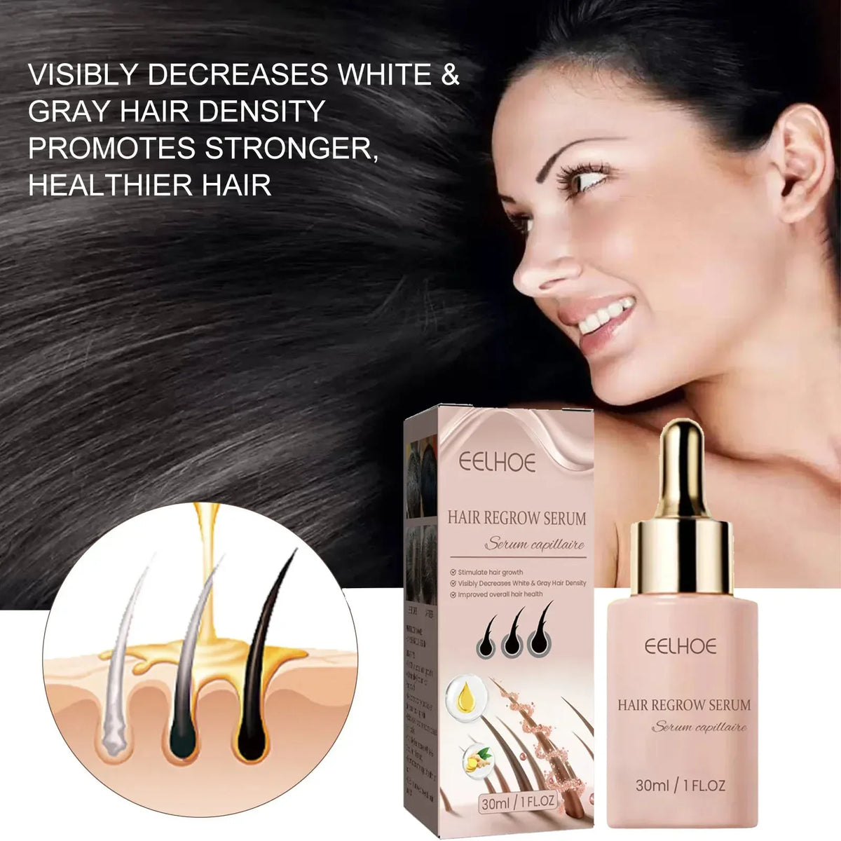 Hair Fast Growth Serum Treatment Hair Thinning Anti Hair Loss Prevent Baldness Scalp Cure Nourish Strong Roots Essence Oil - AliExpress 66