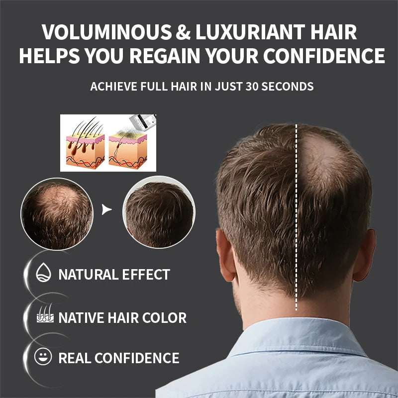 100g Hair Building Fibers Powder 4 Color Keratin Hair Fiber Refill Thickening Spray Instant Regrowth Powder Hair Loss Products - AliExpress 66