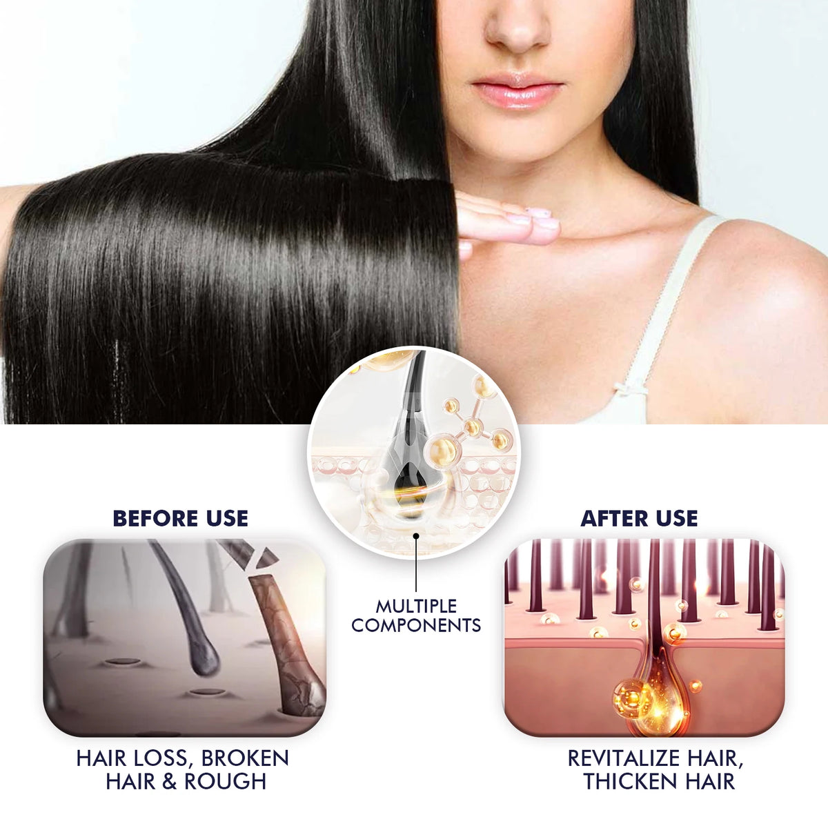 Hair Growth Spray Prevent Baldness Treatment Scalp Dry Damaged Split Hair Dense Strengthen Nourishing Smoothing Massage Liquid - AliExpress 66
