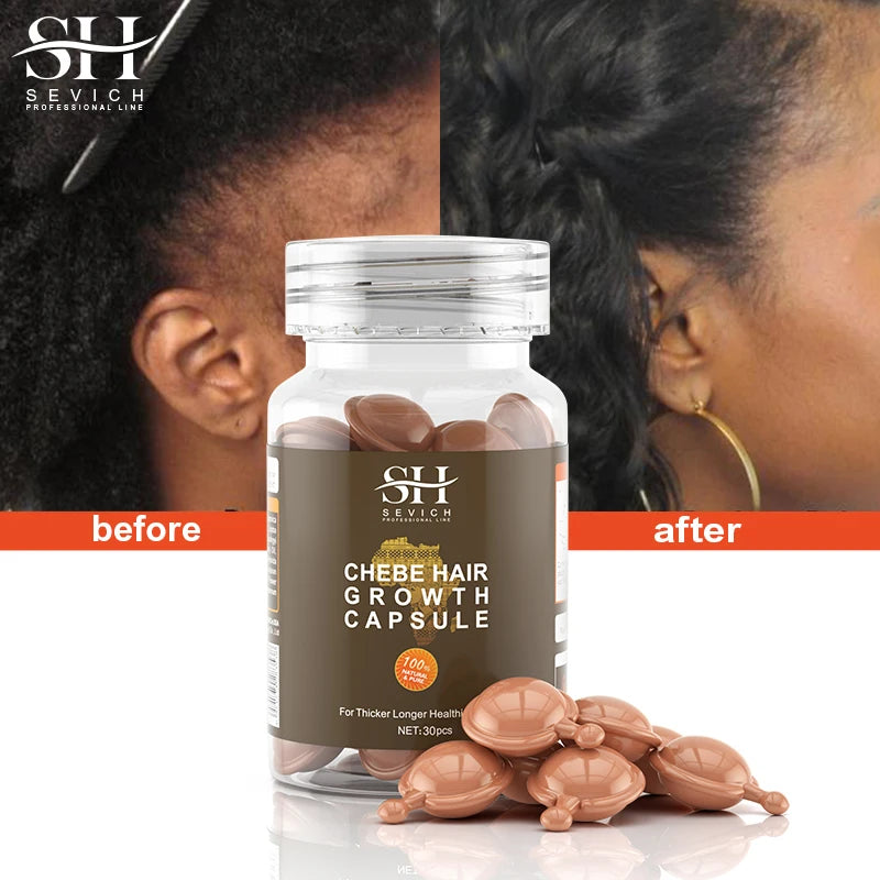 African Chebe Hair Care Capsules Hair Care Essential Oil Anti Preventing Hair Loss Damaged Hair Repair Fast Hair Growth Product - AliExpress 66