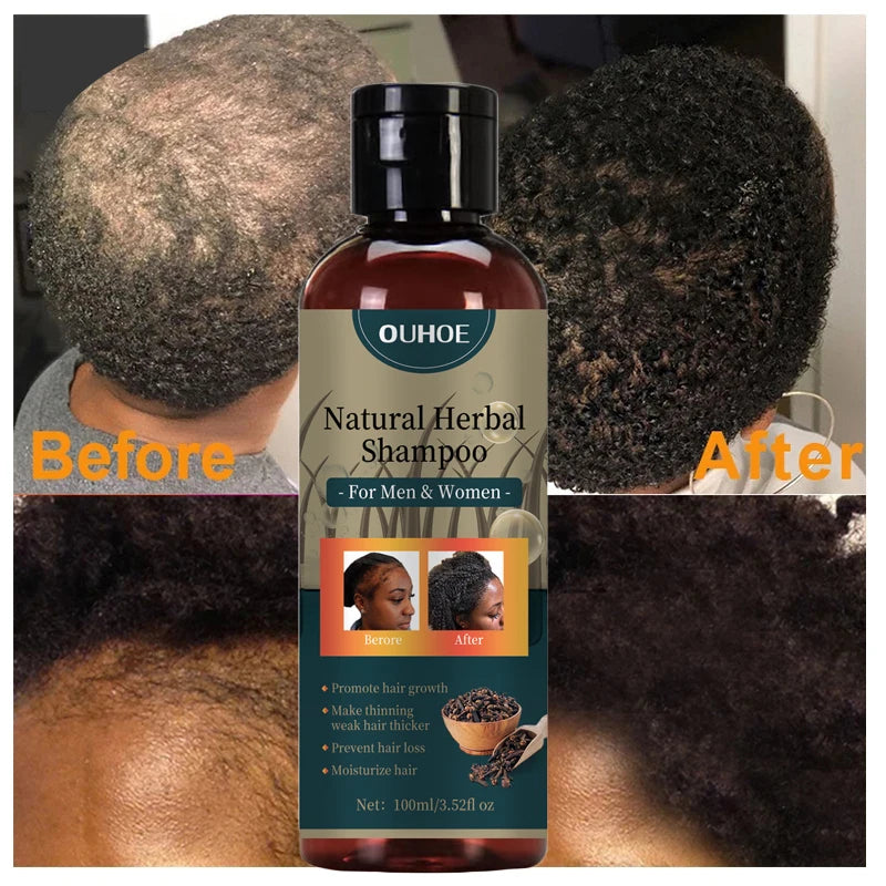 Hair Growth Shampoo Ancient African Hair Growth Formula Extract Powerful Effect Fast Hair Loss Treatment Hair Care 100ml - AliExpress 66
