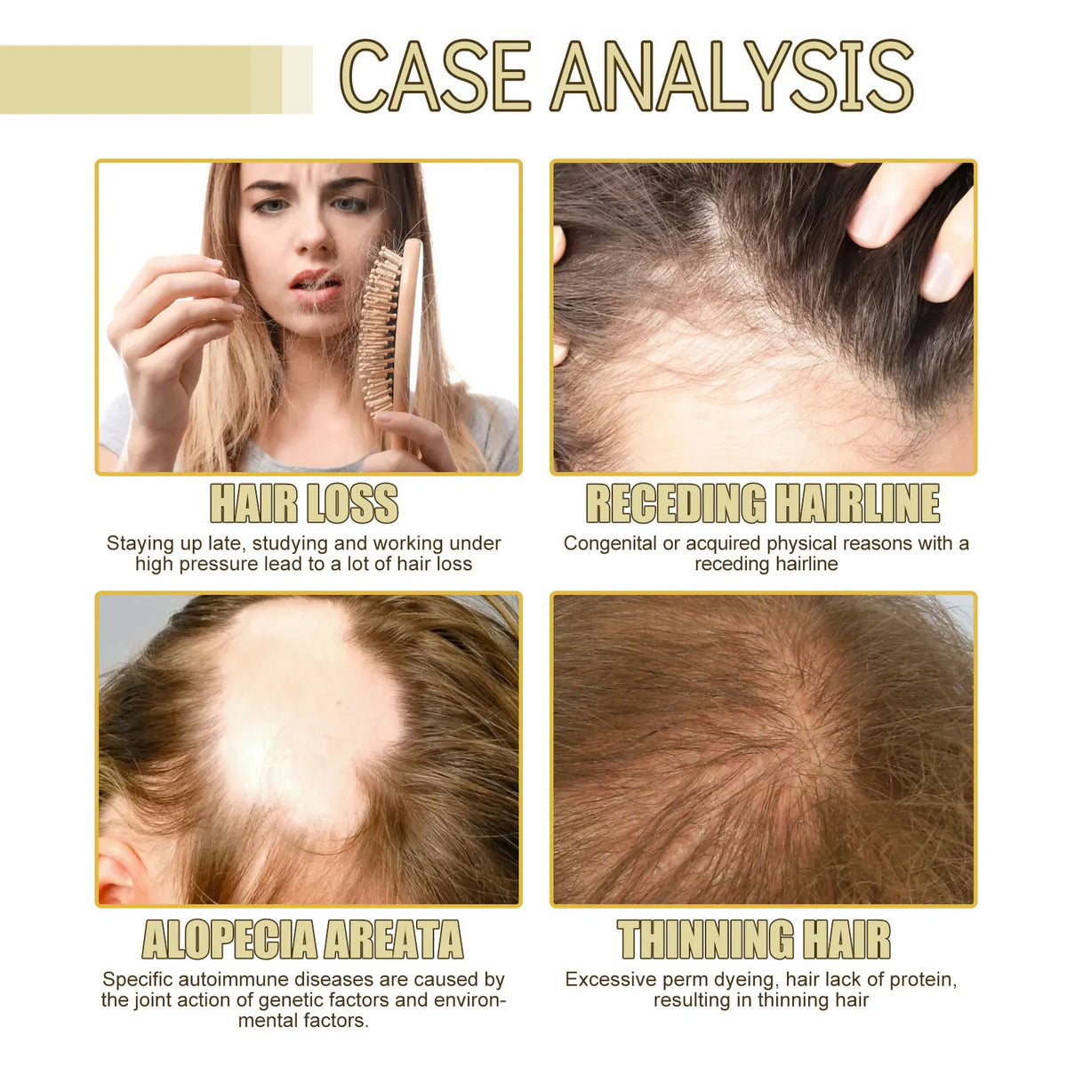 Rosemary Hair Boost Oil Strengthen Thicken Smooth Hair Improve Frizz Prevent Baldness Nourishing Scalp Repair Dense Hair Serum - AliExpress 66
