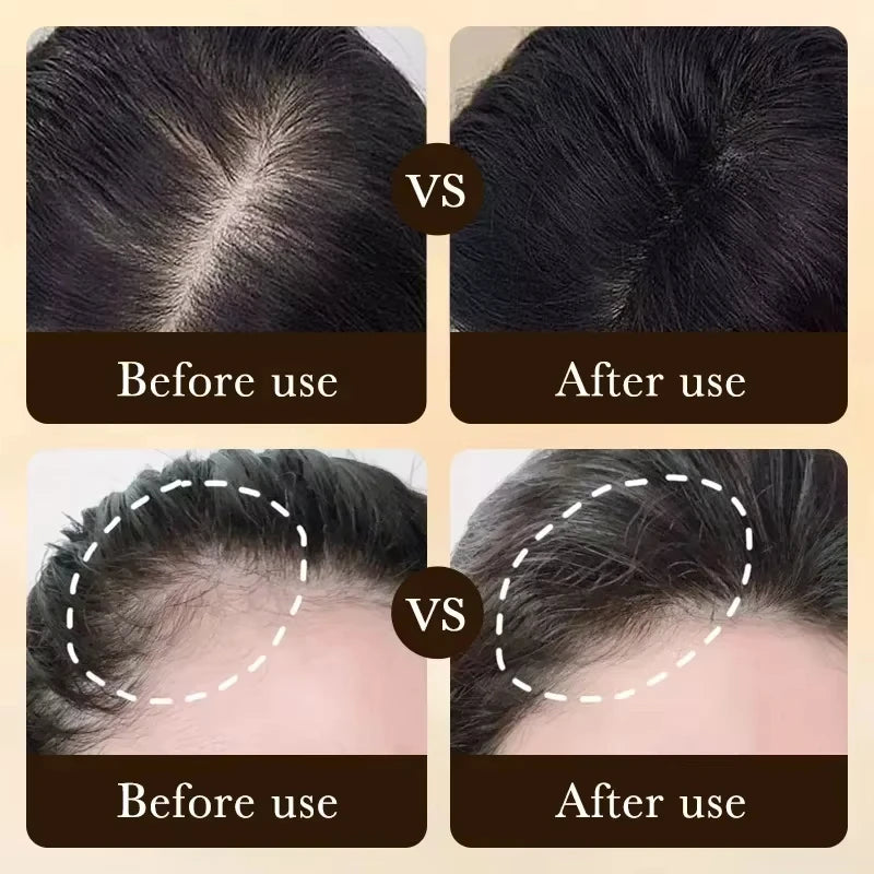 Hair Growth Essential Loss Regrowth Treatment Strengthens Hair Nourishes Scalp Light Weight Non Greasy Improve Scalp Circulation - AliExpress 66
