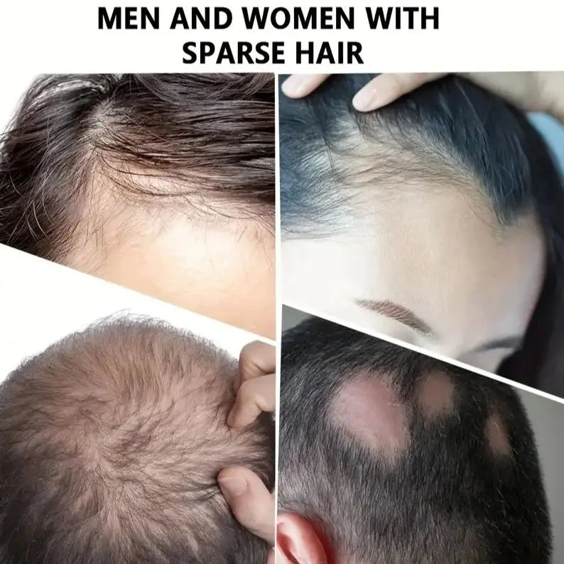 Hair Fiber Powder, 30 G. There Are 11 Colors Available for Selection, It Is a Natural Concealing Product - AliExpress 66