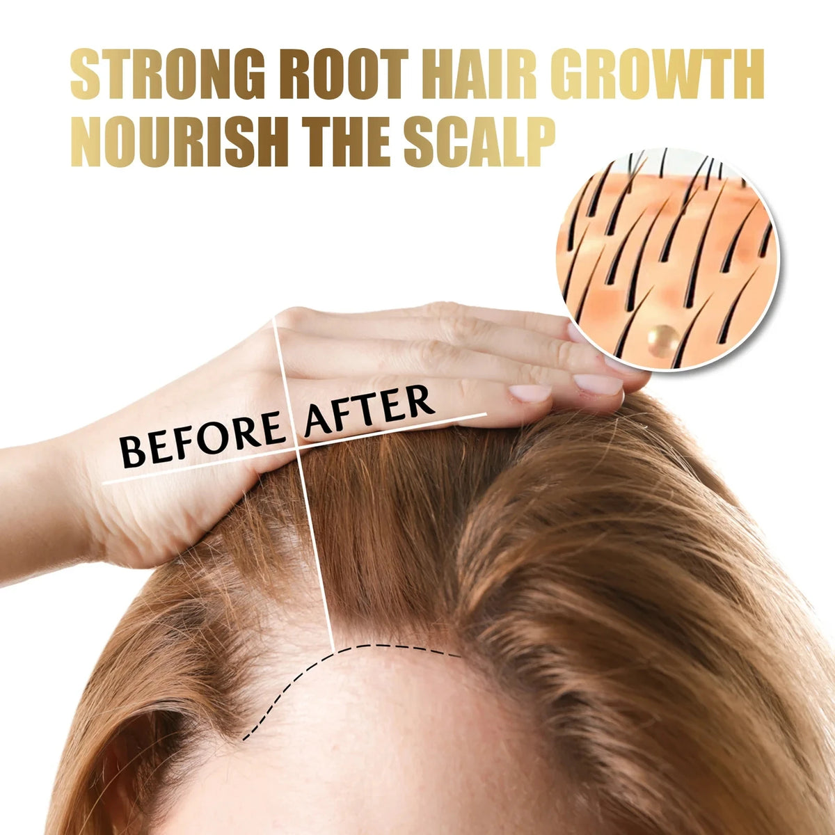 Scalp Cleansing Scrub Remove Dandruff Oil Follicle Treatment Roots Moisturizing Thickening Repair Damaged Frizzy Removal Product - AliExpress 66