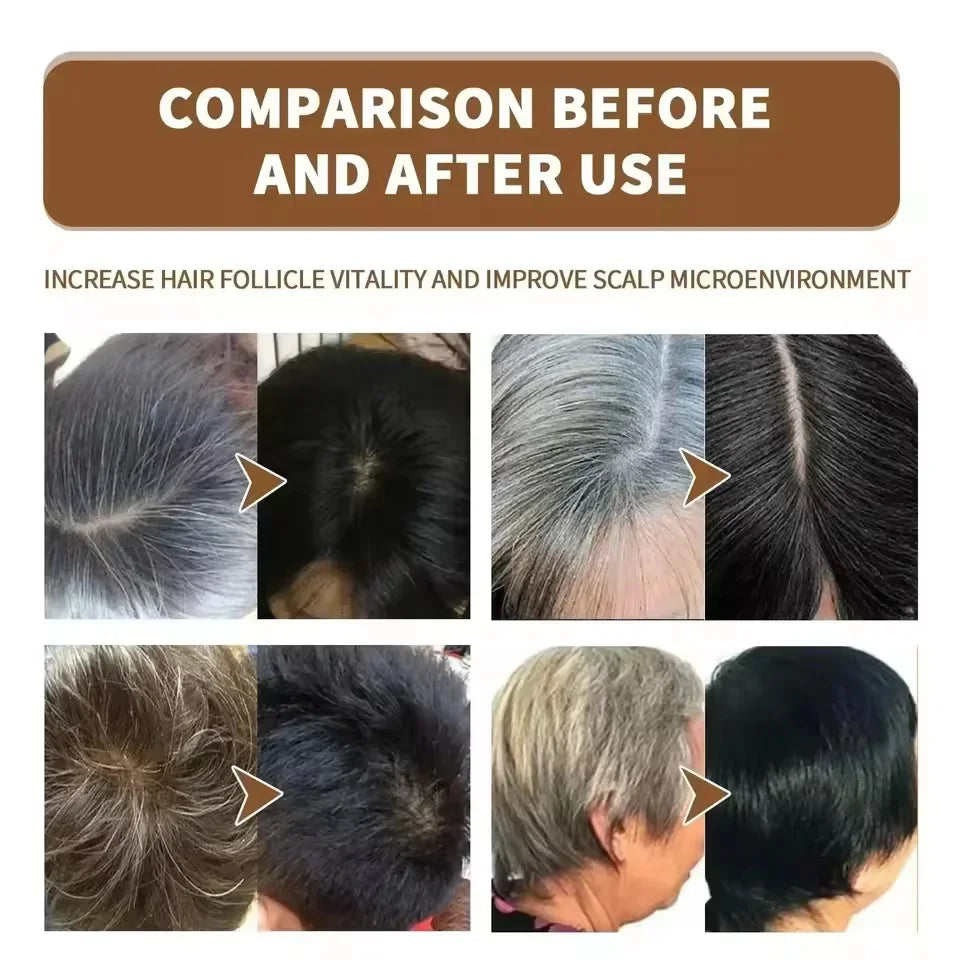 Gray White Hair Treatment Serum Cover White Hair To Black Natural Color Repair Spray Anti Loss Hair Restore Healthy Hair Care - AliExpress 66