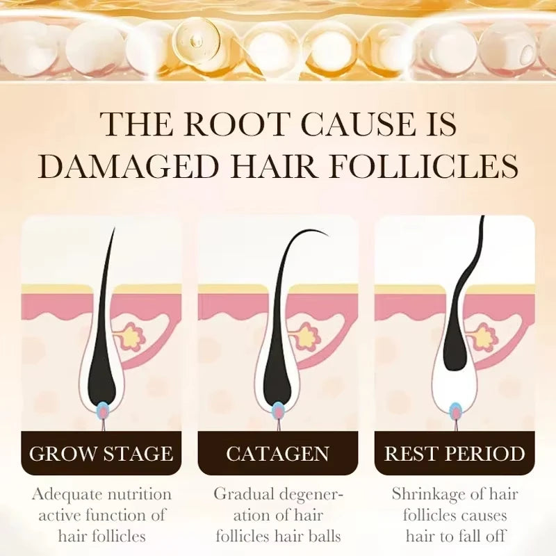 Hair Growth Essential Loss Regrowth Treatment Strengthens Hair Nourishes Scalp Light Weight Non Greasy Improve Scalp Circulation - AliExpress 66