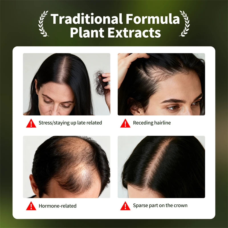 Natural Hair Growth Set Usman Grass Shampoo Soap Herbal Hair Regrowth Oil Anti Hair Loss Serum Scalp Care Spray for Men Women