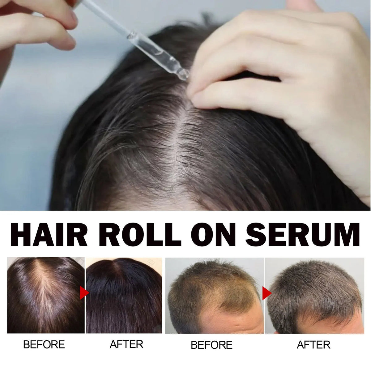 Eelhoe Jojoba Oil Hair Growth Serum Reduce Loss Scalp Treatment More Thicker Keep Regrowth Oil Control Hair Nourish Essencial Oi - AliExpress 66