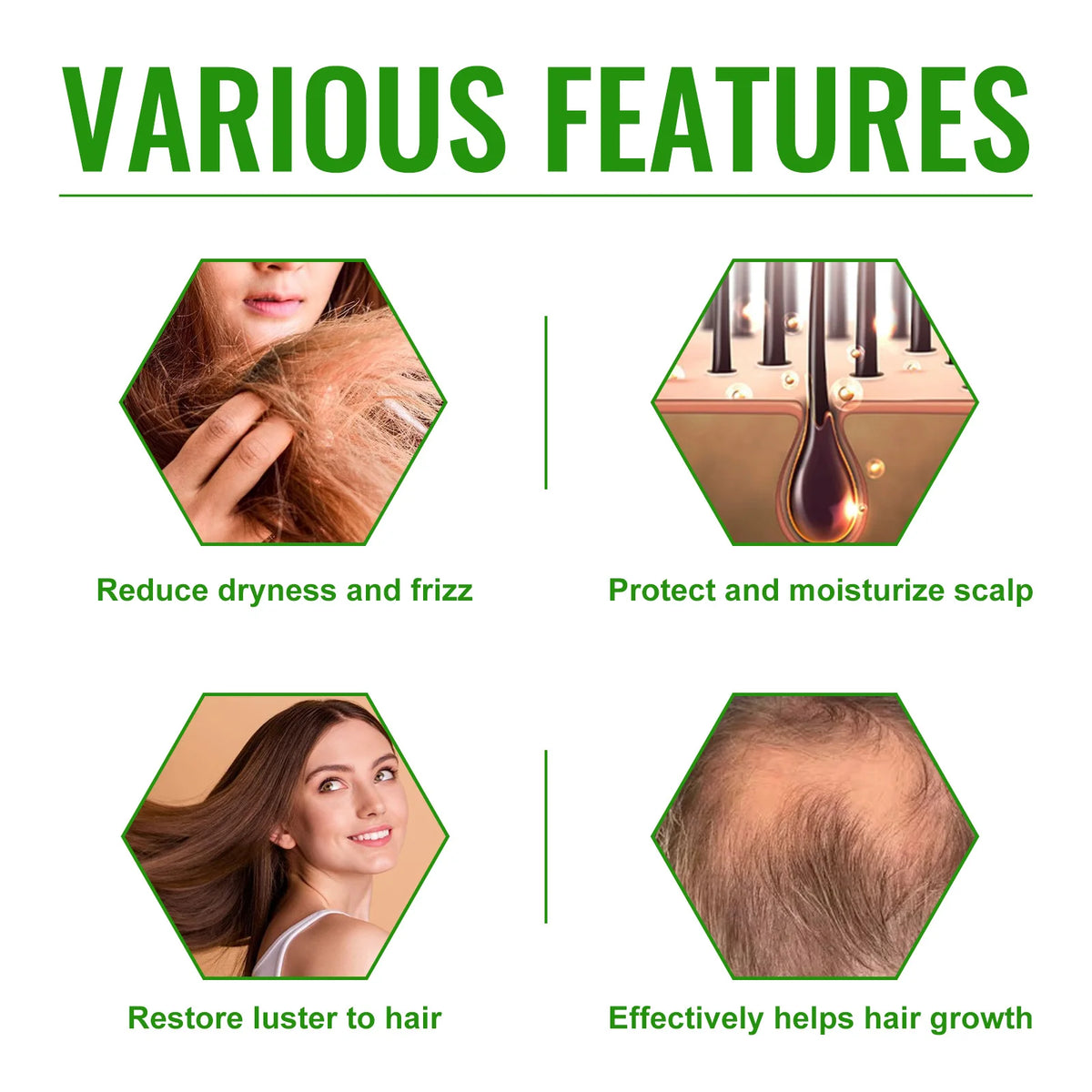 Rosemary Hair Growth Spray - Helps Strengthen Roots, Reduce Hair Loss, Nourish Dry Damaged Hair, Natural Essential Oil Treatment - AliExpress 66