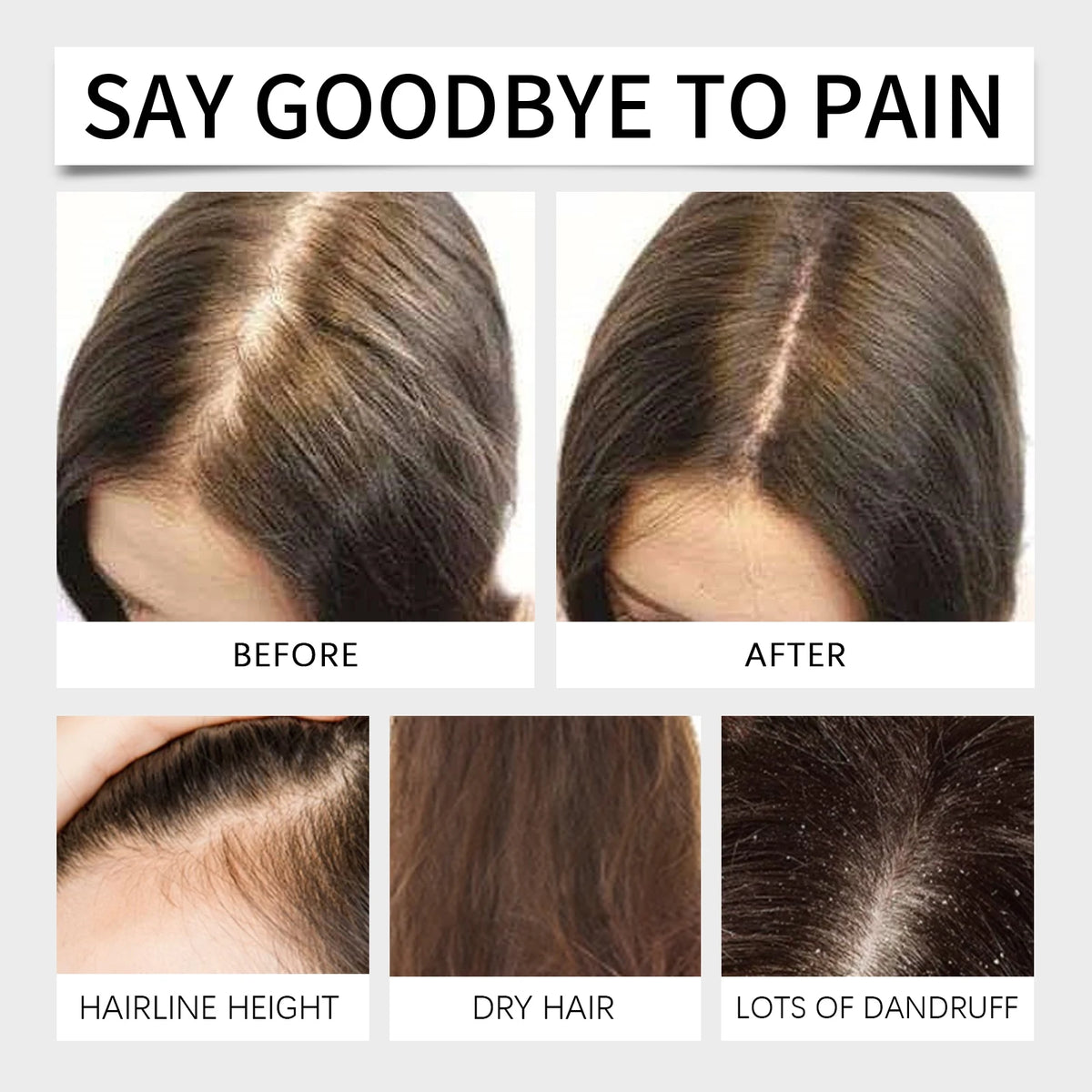 60ml Batana Hair Care Essential Oil Repair Damaged Strengthen Roots Anti-Breakage Oils Scalp Care For Men & Women Hair Care - AliExpress 66