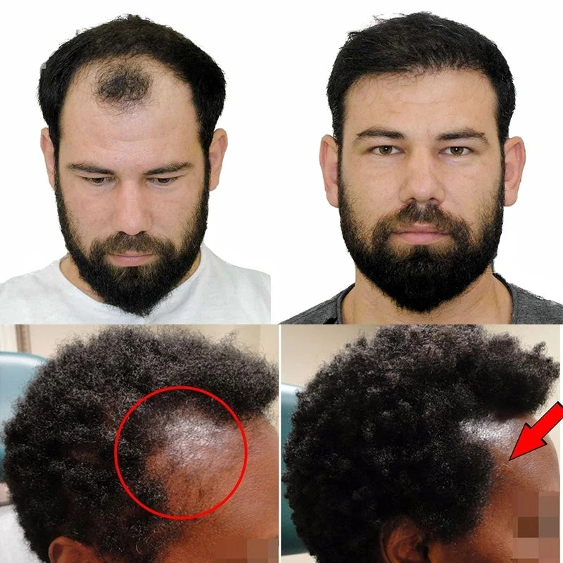 Hair Growth Shampoo Ancient African Hair Growth Formula Extract Powerful Effect Fast Hair Loss Treatment Hair Care 100ml - AliExpress 66