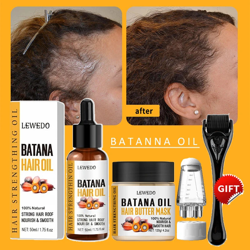 Batana Oil Hair Growth Kit Traction Alopecia Hair Repair Spray Repairs Damage Hair Keratin Hair Scalp Regrowth Treatment Mask - AliExpress 66