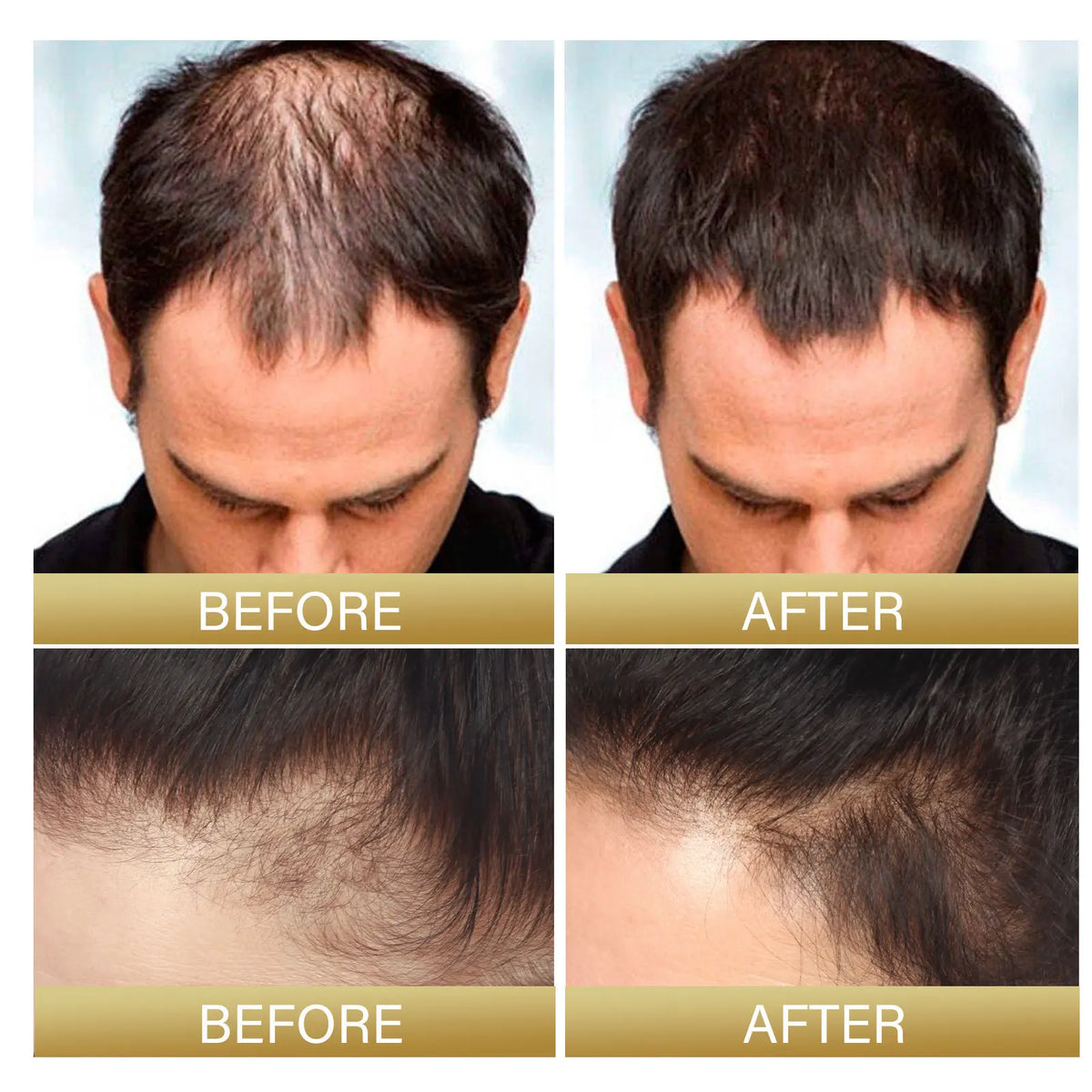 Gray White Hair Treatment Serum Cover White Hair To Black Natural Color Repair Spray Anti Loss Hair Restore Healthy Hair Care - AliExpress 66