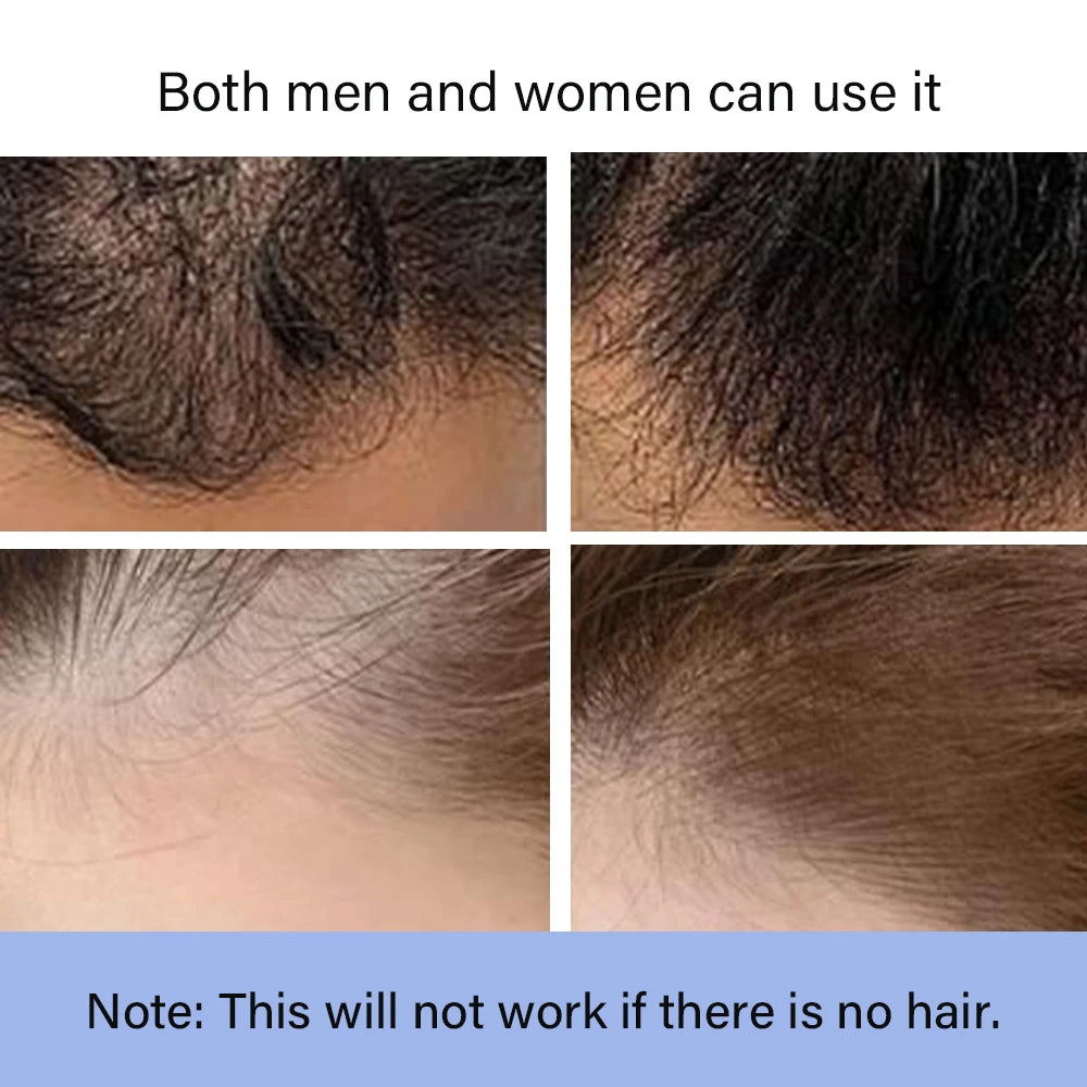 BUNEE 7 Color Hair Fibers Keratin Hair Building Fiber Powder Instant Hair Growth Fiber Refill Hair Care Product 25g - AliExpress 66