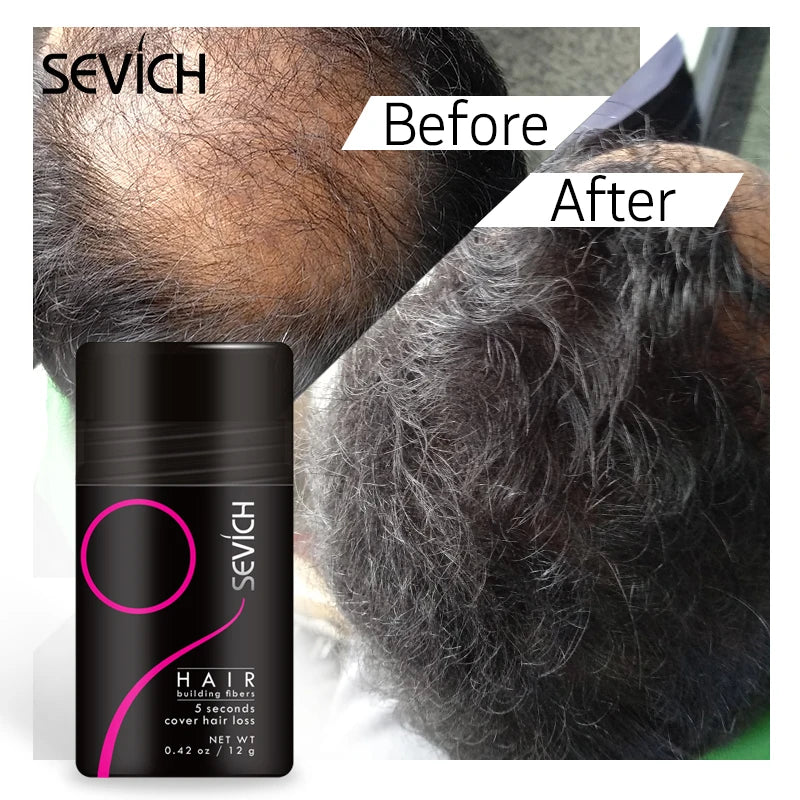 Sevich 12g Hair Fibers Instantly Hair Building Fiber Powders Adds Volume Hair Growth Fiber Salon Professional Hair Care Product - AliExpress 66
