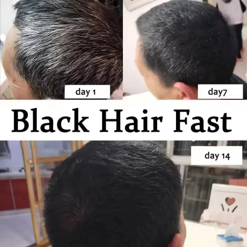 Gray White Hair Treatment Serum Cover White Hair To Black Natural Color Repair Spray Anti Loss Hair Restore Healthy Hair Care - AliExpress 66