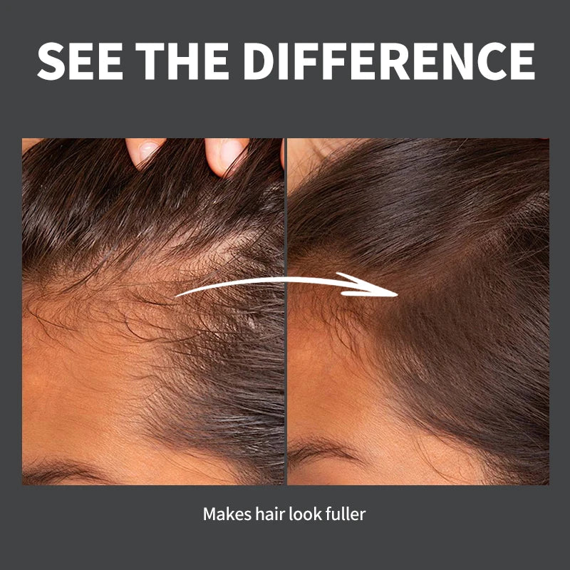 Hairline Shadow Powder Instantly Conceal Hairline And Hair Root Touch Up Waterproof Hairline Powder Filler Hair Root Coverage