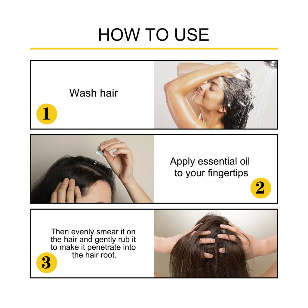 Hair Growth Essential Oil Treatment Seborrheic Alopecia Follicle Repairing Reduce Hairline Baldness Dense Growing Hairs Lotion - AliExpress 66