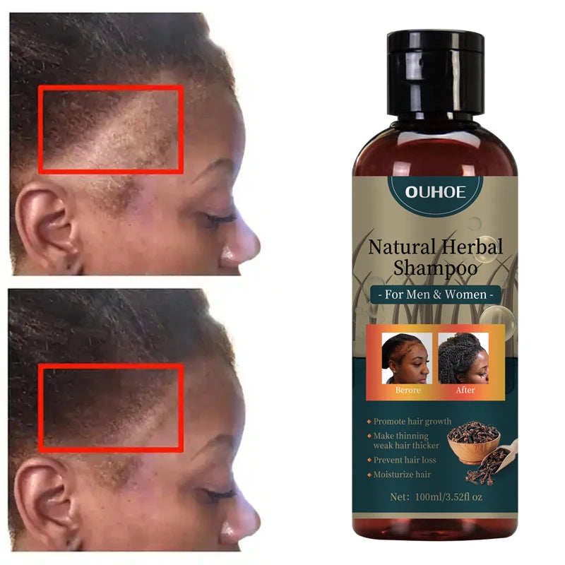Hair Growth Shampoo Ancient African Hair Growth Formula Extract Powerful Effect Fast Hair Loss Treatment Hair Care 100ml - AliExpress 66