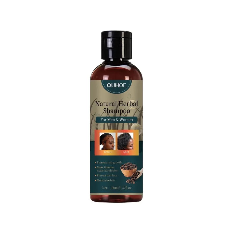 Hair Growth Shampoo Ancient African Hair Growth Formula Extract Powerful Effect Fast Hair Loss Treatment Hair Care 100ml - AliExpress 66