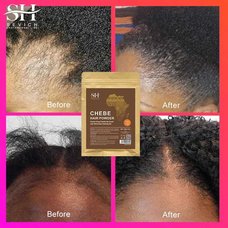 100% Natural Chebe Powder Natural Ingredients Promotes Hair Strengthens & Thickens Anti Hair Loss Hair Regrowth Treatment