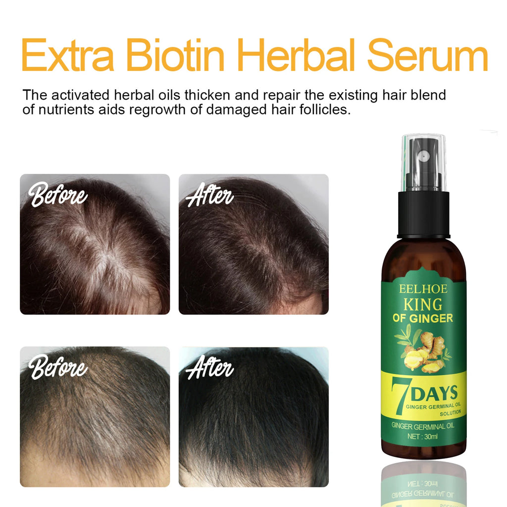 Ginger Oil Hair Booster Serum Spray Nourish Scalp Hair Follicles Refresh Control Oil Strengthen Hair Roots Nutrient Solution - AliExpress 66