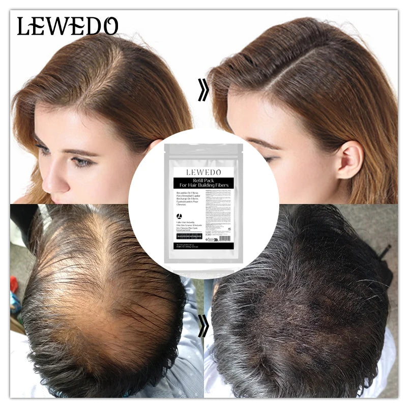 Hair Fiber 100g Natural Hair Thickening Fibers Hair Building Fiber Spray for Balding Areas Fills Part Lines Refill Bag Powder - AliExpress 66