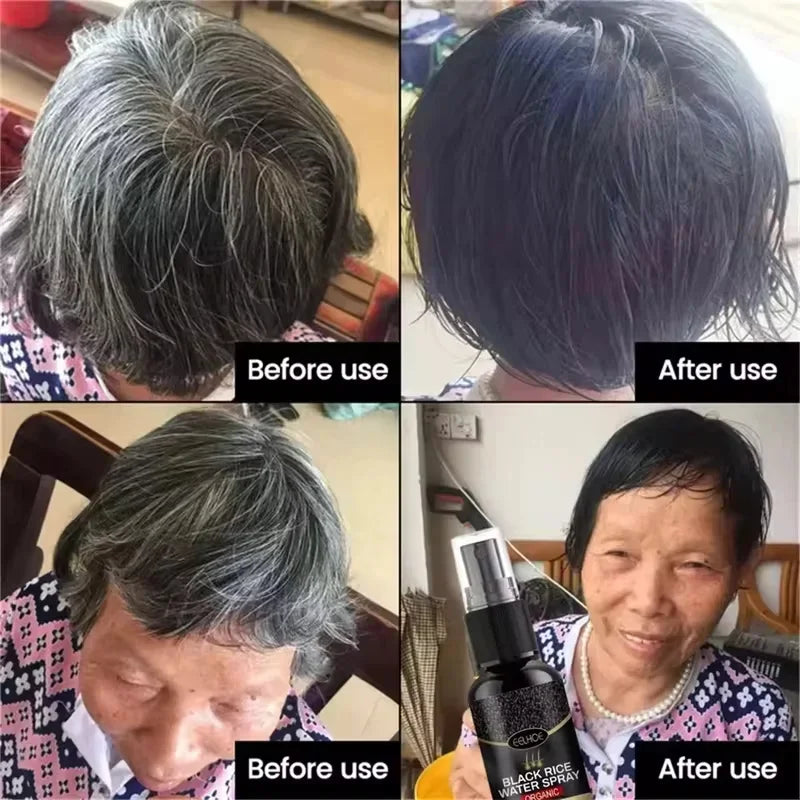 Gray White Hair Treatment Serum Cover White Hair To Black Natural Color Repair Spray Anti Loss Hair Restore Healthy Hair Care - AliExpress 66
