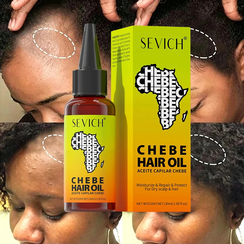 Chebe Oil Fast Hair Strengthens Products African Chebe Hair Growth Oil Repair Damaged Scalp Anti Hair Loss Hair Anti Hair Break