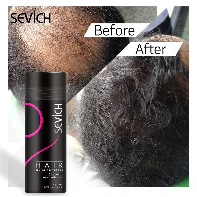 10 Colors Hair Fibers Powders Regrowth Powder Hair Keratin Building Fiber Refill Bag Bald Extension Hair Fiber Hair Care Product - AliExpress 66