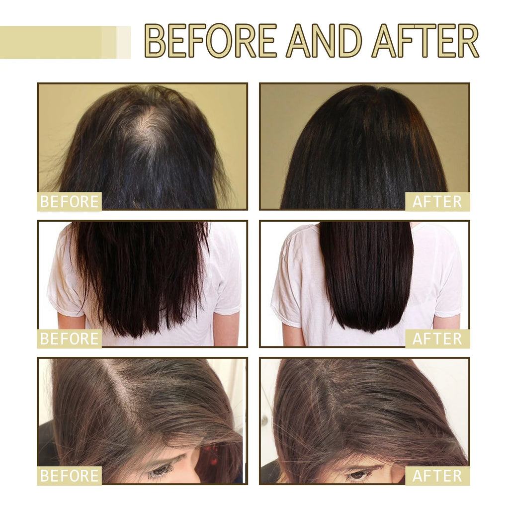 Rosemary Hair Growth Oil 60ml Anti Hair Loss Treatment For Thicker Hair Repairing Dry Damaged Hair Scalp Care With Argan Oil - AliExpress 66