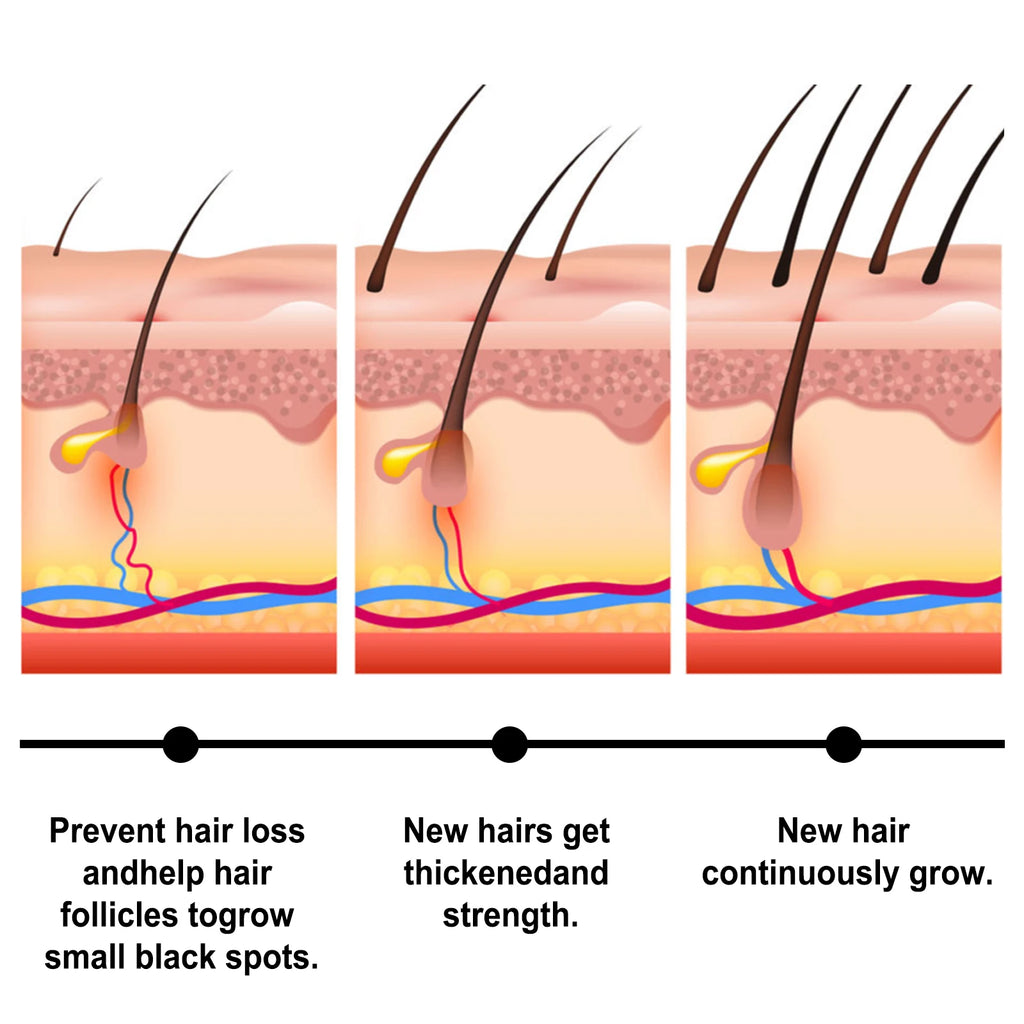 Batana Hair Regrowth Serum Anti-Hair Loss Deeply Nourishing Strengthening Roots Keep Soft Repair Damaged Dry Hair Scalp Care Oil - AliExpress 66