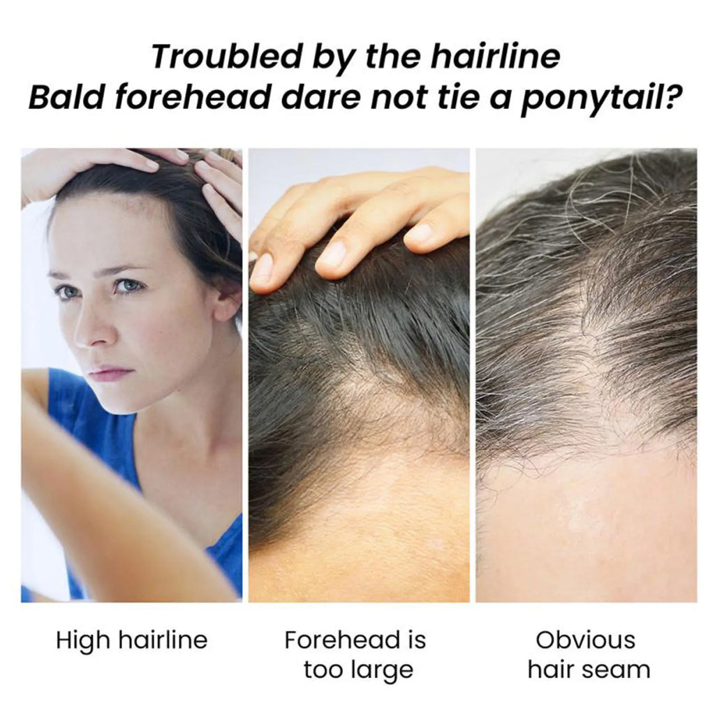 Eelhoe Jojoba Oil Hair Growth Serum Reduce Loss Scalp Treatment More Thicker Keep Regrowth Oil Control Hair Nourish Essencial Oi - AliExpress 66