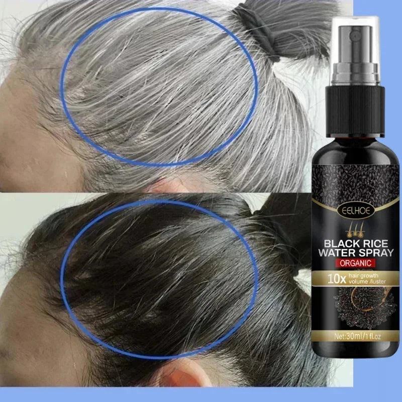 Gray White Hair Treatment Serum Cover White Hair To Black Natural Color Repair Spray Anti Loss Hair Restore Healthy Hair Care - AliExpress 66