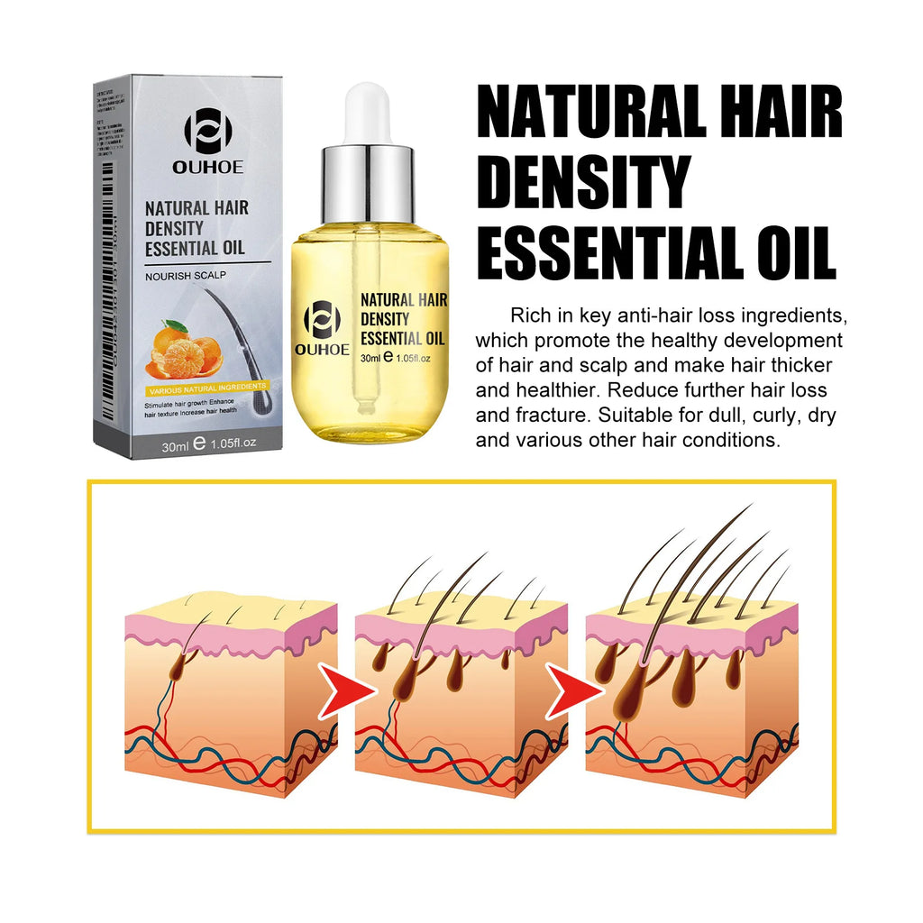 Hair Growth Essential Oil Treatment Seborrheic Alopecia Follicle Repairing Reduce Hairline Baldness Dense Growing Hairs Lotion - AliExpress 66