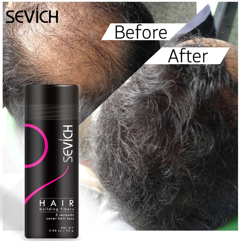 Sevich Hair Building Fibers Powder Spray Keratin Thicker Anti Hair Loss Products Instant Hair Growth Fiber Hair Care Christmas - AliExpress 66