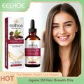 Eelhoe Jojoba Oil Hair Growth Serum Reduce Loss Scalp Treatment More Thicker Keep Regrowth Oil Control Hair Nourish Essencial Oi - AliExpress 66