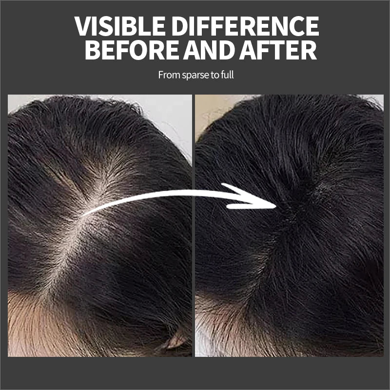 Hair Fiber Kit 25g Hair Building Fibers Unisex Instantly Adds Volume Conceals Thinning Areas for Fuller Hair Powder Nozzle Set