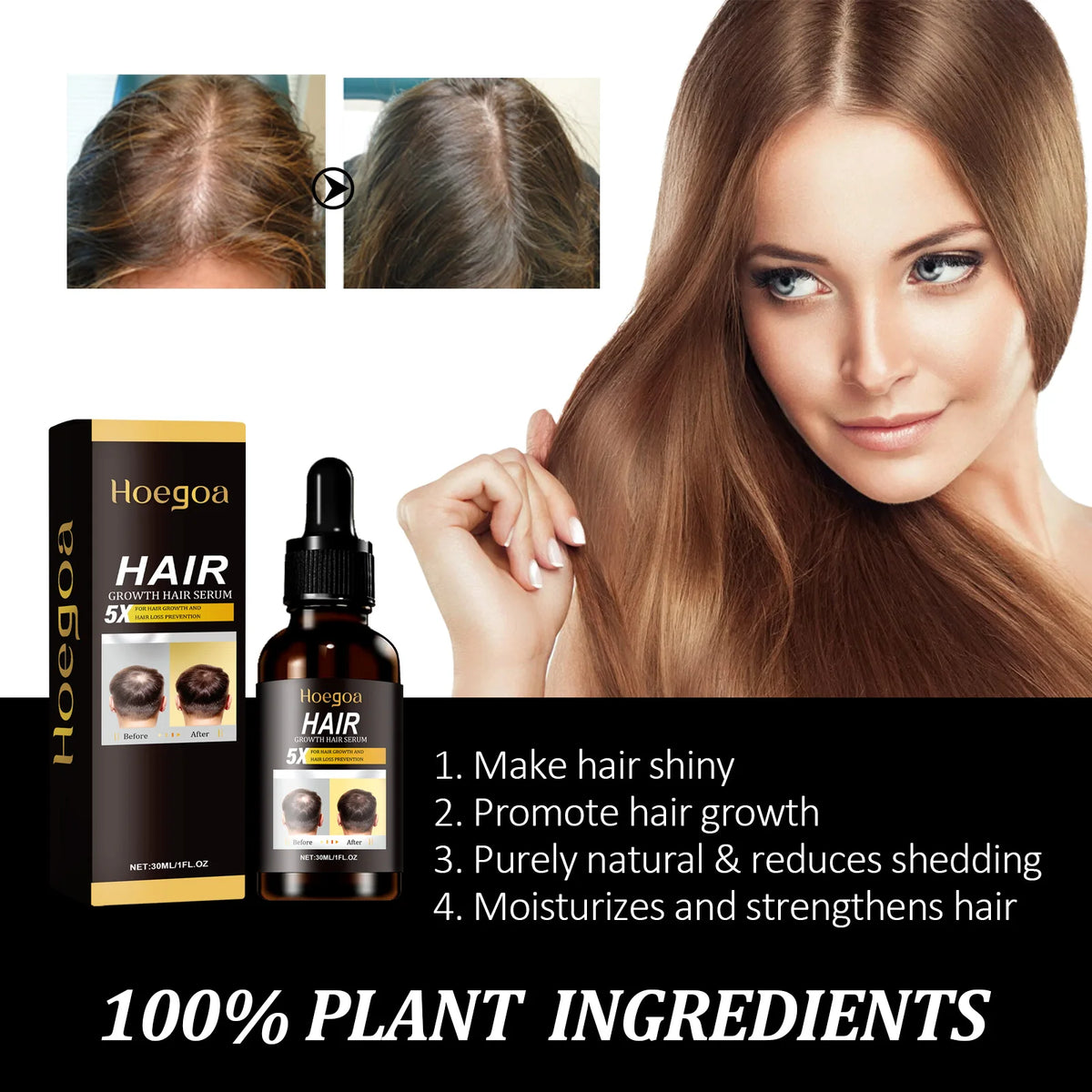 Hair Care Serum Oil Ginger Hair Regrowth Anti-Hair Loss Repairing Nourish Damaged Hair Roots Dense Essence Hair Conditioner - AliExpress 66