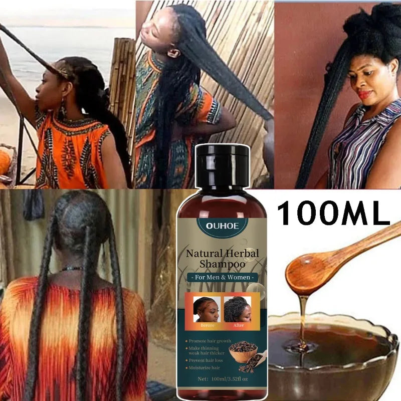 Hair Growth Shampoo Ancient African Hair Growth Formula Extract Powerful Effect Fast Hair Loss Treatment Hair Care 100ml - AliExpress 66